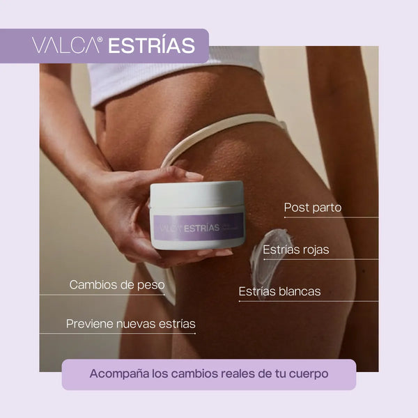 Valca Estrías® | Tratamiento estrias