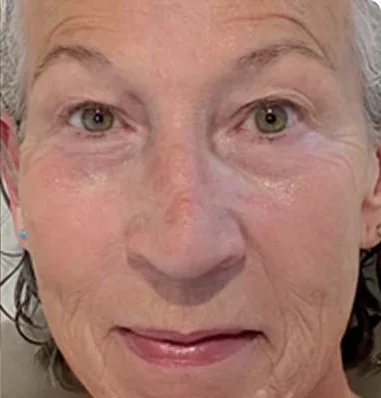 Marta González — 65 años
