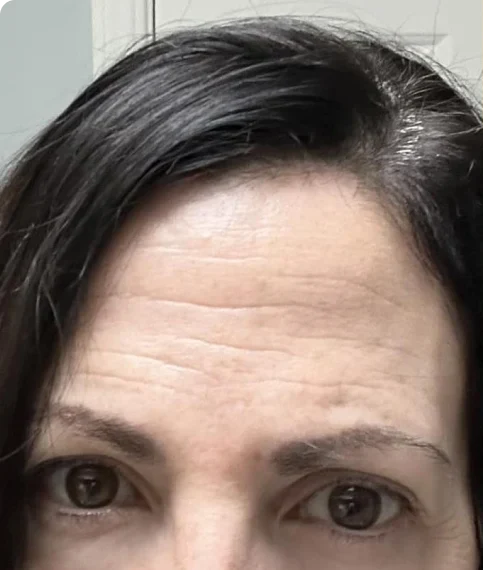 Laura Martínez — 42 años
