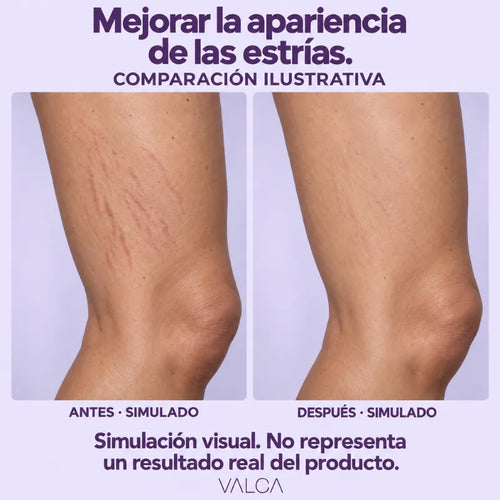 Combo Valca Estrías x 3 + Pocket 10ml - Beauty Week