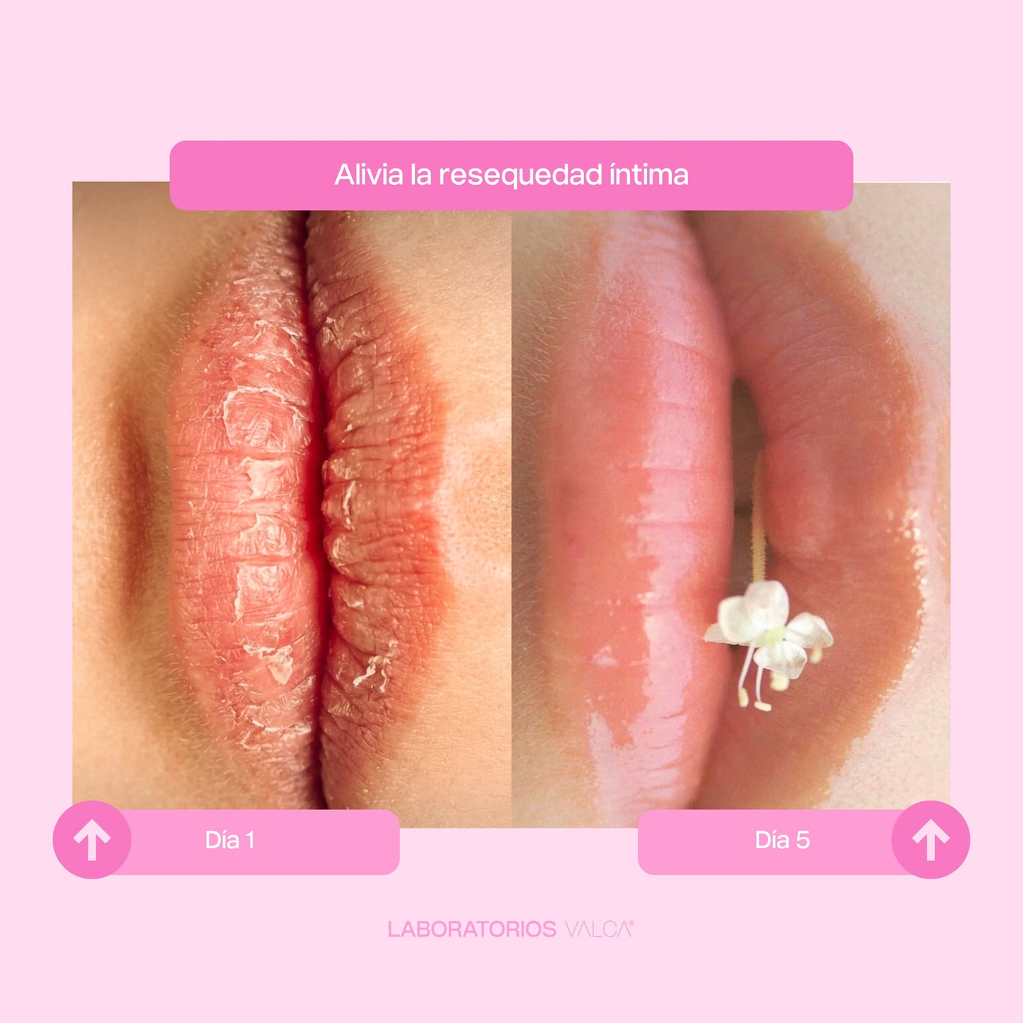 VALCA ÍNTIMA® | Confort Íntimo Prolongado