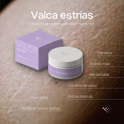 Valca Estrías® | Tratamiento Anti-estrías